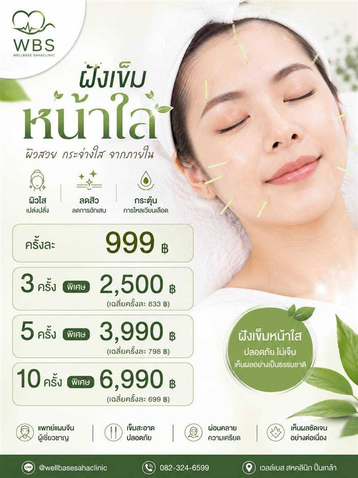 ฝังเข็มหน้าใส — สอบถาม/จองคิวทาง Line