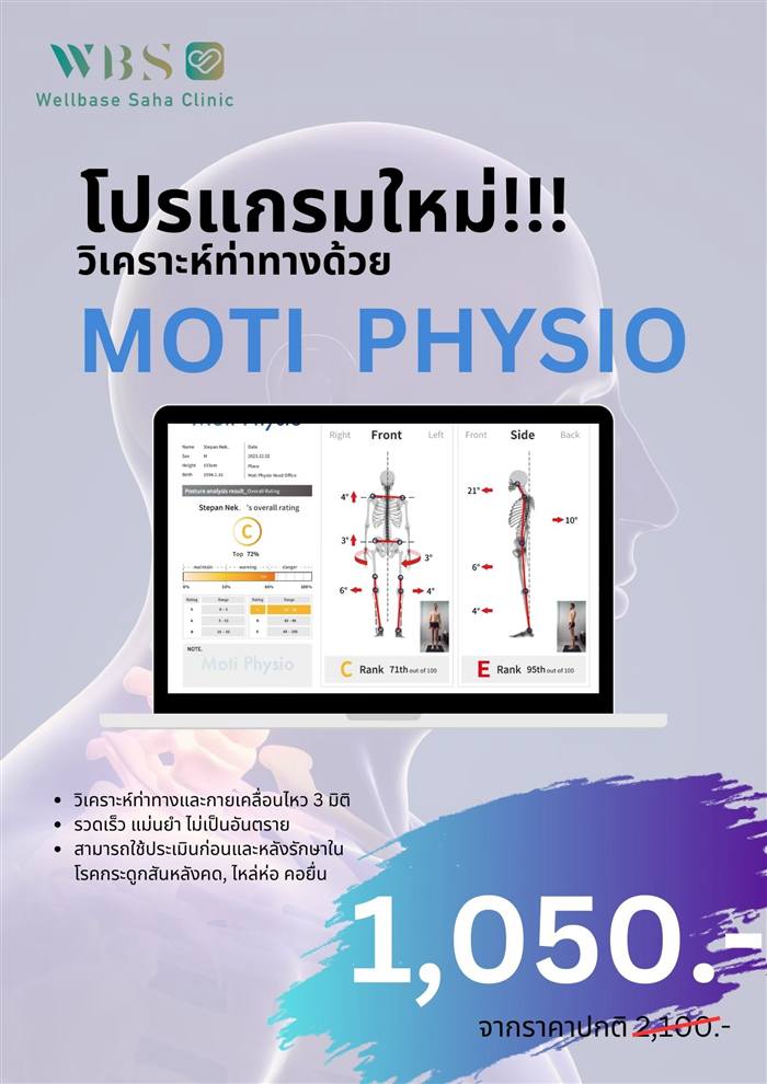 MOTI PHYSIO วิเคราะห์ท่าทาง 3 มิติ — สอบถาม/จองคิวทาง Line